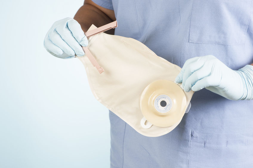 Understanding Ostomy Care