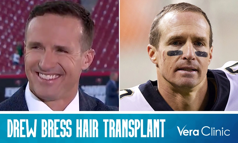 Drew brees makes his nbc debut, internet amazed by his new hair